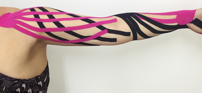 Linfotaping